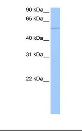 CHN1 Antibody - Jurkat cell lysate. Antibody concentration: 0.5 ug/ml. Gel concentration: 12%.  This image was taken for the unconjugated form of this product. Other forms have not been tested.