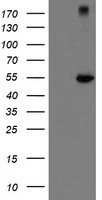 CHN1 Antibody - HEK293T cells were transfected with the pCMV6-ENTRY control (Left lane) or pCMV6-ENTRY CHN1 (Right lane) cDNA for 48 hrs and lysed. Equivalent amounts of cell lysates (5 ug per lane) were separated by SDS-PAGE and immunoblotted with anti-CHN1.