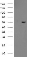 CHN1 Antibody - HEK293T cells were transfected with the pCMV6-ENTRY control (Left lane) or pCMV6-ENTRY CHN1 (Right lane) cDNA for 48 hrs and lysed. Equivalent amounts of cell lysates (5 ug per lane) were separated by SDS-PAGE and immunoblotted with anti-CHN1.