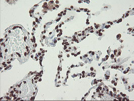 CHN1 Antibody - IHC of paraffin-embedded Human lung tissue using anti-CHN1 mouse monoclonal antibody. (Heat-induced epitope retrieval by 10mM citric buffer, pH6.0, 100C for 10min).