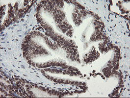 CHN1 Antibody - IHC of paraffin-embedded Human prostate tissue using anti-CHN1 mouse monoclonal antibody. (Heat-induced epitope retrieval by 10mM citric buffer, pH6.0, 100C for 10min).