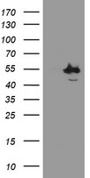 CHN1 Antibody - HEK293T cells were transfected with the pCMV6-ENTRY control (Left lane) or pCMV6-ENTRY CHN1 (Right lane) cDNA for 48 hrs and lysed. Equivalent amounts of cell lysates (5 ug per lane) were separated by SDS-PAGE and immunoblotted with anti-CHN1.