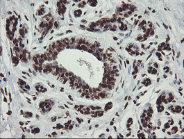 CHN1 Antibody - IHC of paraffin-embedded Human breast tissue using anti-CHN1 mouse monoclonal antibody. (Heat-induced epitope retrieval by 10mM citric buffer, pH6.0, 100C for 10min).