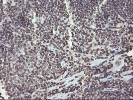 CHN1 Antibody - IHC of paraffin-embedded Human lymphoma tissue using anti-CHN1 mouse monoclonal antibody. (Heat-induced epitope retrieval by 10mM citric buffer, pH6.0, 100C for 10min).