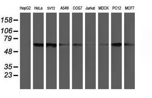 CHN1 Antibody - Western blot of extracts (35 ug) from 9 different cell lines by using g anti-CHN1 monoclonal antibody (HepG2: human; HeLa: human; SVT2: mouse; A549: human; COS7: monkey; Jurkat: human; MDCK: canine; PC12: rat; MCF7: human).