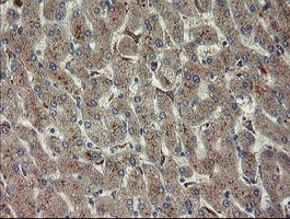 CHN1 Antibody - IHC of paraffin-embedded Human liver tissue using anti-CHN1 mouse monoclonal antibody.