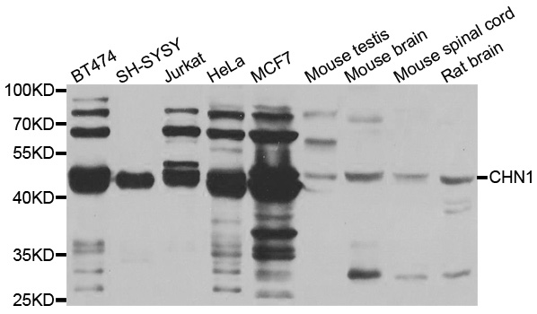 CHN1 Antibody - Western blot analysis of extracts of various cell lines.