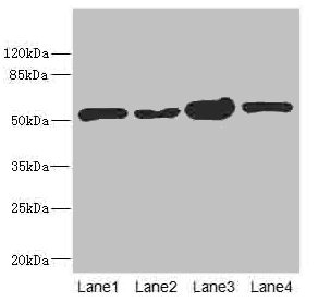 CHN1 Antibody - Western blot All Lanes: CHN1 antibody at 6.08ug/ml Lane 1: 293T whole cell lysate Lane 2: MCF7 whole cell lysate Lane 3: Jurkat whole cell lysate Lane 4: Hela whole cell lysate Goat polyclonal to Rabbit IgG at 1/10000 dilution Predicted band size: 54,39,51 kDa Observed band size: 53 kDa