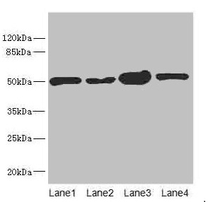 CHN1 Antibody - Western blot All lanes: CHN1 antibody at 6.08µg/ml Lane 1: 293T whole cell lysate Lane 2: MCF-7 whole cell lysate Lane 3: Jurkat whole cell lysate Lane 4: Hela whole cell lysate Secondary Goat polyclonal to rabbit IgG at 1/10000 dilution Predicted band size: 54, 39, 51 kDa Observed band size: 51 kDa
