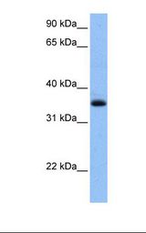 CHN2 / Chimerin 2 Antibody - Fetal liver cell lysate. Antibody concentration: 1.0 ug/ml. Gel concentration: 12%.  This image was taken for the unconjugated form of this product. Other forms have not been tested.