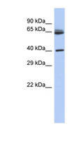 CHN2 / Chimerin 2 Antibody - CHN2 antibody Western blot of Fetal Thymus lysate. This image was taken for the unconjugated form of this product. Other forms have not been tested.