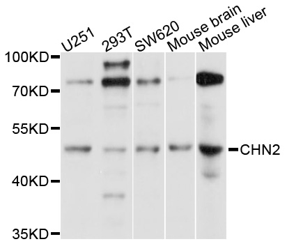 CHN2 / Chimerin 2 Antibody - Western blot analysis of extracts of various cell lines.