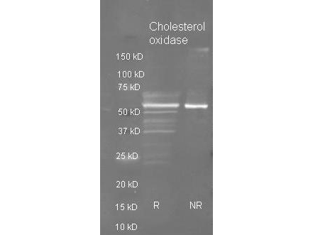 choD Antibody - Goat anti Cholesterol oxidase antibody was used to detect purified cholesterol oxidase under reducing (R) and non-reducing (NR) conditions. Reduced samples of purified cholesterol oxidase contained 4% BME and were boiled for 5 minutes. Samples of ~1ug of protein per lane were run by SDS-PAGE. Protein was transferred to nitrocellulose and probed with a 1:3000 dilution of primary antibody. Detection shown was using Dylight 488 conjugated Donkey anti goat. Images were collected using the BioRad VersaDoc System