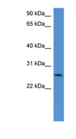CHODL / Chondrolectin Antibody - CHODL antibody Western blot of Mouse Kidney lysate. This image was taken for the unconjugated form of this product. Other forms have not been tested.