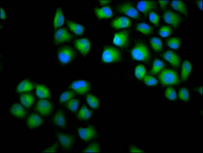 CHODL / Chondrolectin Antibody - Immunofluorescence staining of Hela cells diluted at 1:100, counter-stained with DAPI. The cells were fixed in 4% formaldehyde, permeabilized using 0.2% Triton X-100 and blocked in 10% normal Goat Serum. The cells were then incubated with the antibody overnight at 4°C.The Secondary antibody was Alexa Fluor 488-congugated AffiniPure Goat Anti-Rabbit IgG (H+L).