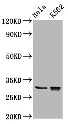 CHODL / Chondrolectin Antibody - Western Blot Positive WB detected in: Hela whole cell lysate, K562 whole cell lysate All Lanes: CHODL antibody at 6.2µg/ml Secondary Goat polyclonal to rabbit IgG at 1/50000 dilution Predicted band size: 31, 26, 28, 29 KDa Observed band size: 31 KDa