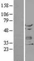 CHODL / Chondrolectin Protein - Western validation with an anti-DDK antibody * L: Control HEK293 lysate R: Over-expression lysate