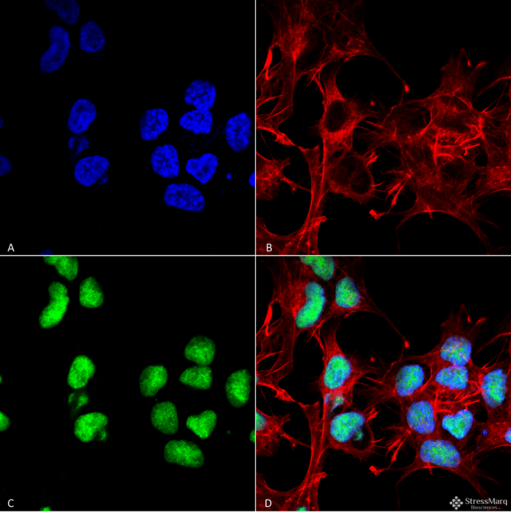 Choline Acetyltransferase Antibody - Immunocytochemistry/Immunofluorescence analysis using Rabbit Anti-Choline Acetyltransferase Polyclonal Antibody. Tissue: Neuroblastoma cell line (SK-N-BE). Species: Human. Fixation: 4% Formaldehyde for 15 min at RT. Primary Antibody: Rabbit Anti-Choline Acetyltransferase Polyclonal Antibody  at 1:100 for 60 min at RT. Secondary Antibody: Goat Anti-Rabbit ATTO 488 at 1:100 for 60 min at RT. Counterstain: Phalloidin Texas Red F-Actin stain; DAPI (blue) nuclear stain at 1:1000, 1:5000 for 60min RT, 5min RT. Localization: Nucleus. Magnification: 60X. (A) DAPI (blue) nuclear stain (B) Phalloidin Texas Red F-Actin stain (C) Choline Acetyltransferase Antibody (D) Composite.