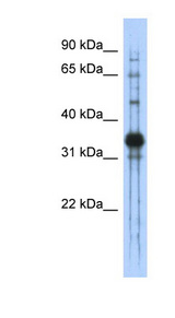Chondroadherin / CHAD Antibody - CHAD antibody Western blot of Transfected 293T cell lysate. This image was taken for the unconjugated form of this product. Other forms have not been tested.