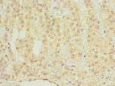 Chondroadherin / CHAD Antibody - Immunohistochemistry of paraffin-embedded human adrenal gland tissue using antibody at dilution of 1:100.