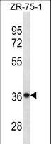 CHORDC1 / CHP1 Antibody - CHORDC1 Antibody western blot of ZR-75-1 cell line lysates (35 ug/lane). The CHORDC1 antibody detected the CHORDC1 protein (arrow).