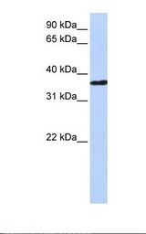 CHORDC1 / CHP1 Antibody - Fetal heart lysate. Antibody concentration: 1.0 ug/ml. Gel concentration: 12%.  This image was taken for the unconjugated form of this product. Other forms have not been tested.