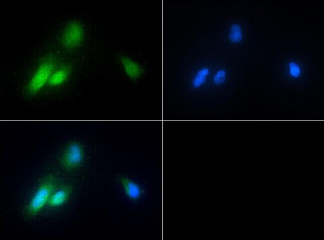 CHORDC1 / CHP1 Antibody - Immunocytochemistry/Immunofluorescence: CHORDC1 Antibody - Antibody was tested in HeLa cells with FITC (green). Nuclei were counterstained with DAPI (blue).  This image was taken for the unconjugated form of this product. Other forms have not been tested.