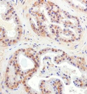 CHORDC1 / CHP1 Antibody - Immunohistochemistry: CHORDC1 Antibody - Analysis of CHORDC1 in mouse prostate using DAB with hematoxylin counterstain.  This image was taken for the unconjugated form of this product. Other forms have not been tested.