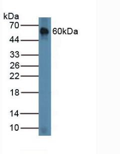 Chordin Antibody - Western Blot; Sample: Mouse Lung Tissue.