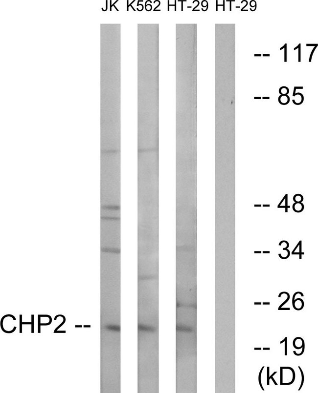 CHP2 Antibody - Western blot analysis of lysates from HT-29, K562, and Jurkat cells, using CHP2 Antibody. The lane on the right is blocked with the synthesized peptide.