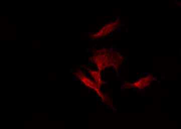 CHP2 Antibody - Staining HT29 cells by IF/ICC. The samples were fixed with PFA and permeabilized in 0.1% Triton X-100, then blocked in 10% serum for 45 min at 25°C. The primary antibody was diluted at 1:200 and incubated with the sample for 1 hour at 37°C. An Alexa Fluor 594 conjugated goat anti-rabbit IgG (H+L) Ab, diluted at 1/600, was used as the secondary antibody.