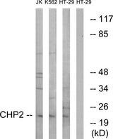 CHP2 Antibody - Western blot analysis of extracts from Jurkat cells, K562 cells and HT-29 cells, using CHP2 antibody.