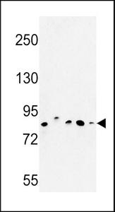 CHPF / CHSY2 Antibody - Western blot of CHPF Antibody in MDA-MB435, MCF-7, HepG2, A375 cell line and mouse testis tissue lysates (35 ug/lane). CHPF (arrow) was detected using the purified antibody.