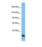 CHPF / CHSY2 Antibody - Western blot of Human Esophagus Tumor. CHSY2 antibody dilution 1.0 ug/ml.  This image was taken for the unconjugated form of this product. Other forms have not been tested.