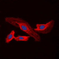 CHPF / CHSY2 Antibody - Immunofluorescent analysis of CHSY2 staining in A549 cells. Formalin-fixed cells were permeabilized with 0.1% Triton X-100 in TBS for 5-10 minutes and blocked with 3% BSA-PBS for 30 minutes at room temperature. Cells were probed with the primary antibody in 3% BSA-PBS and incubated overnight at 4 C in a humidified chamber. Cells were washed with PBST and incubated with a DyLight 594-conjugated secondary antibody (red) in PBS at room temperature in the dark. DAPI was used to stain the cell nuclei (blue).