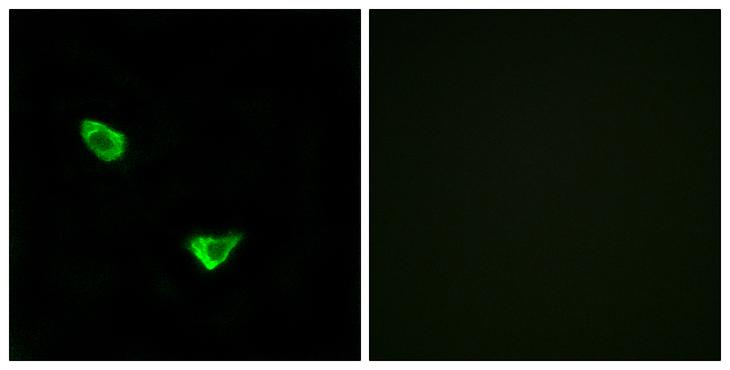 CHPF / CHSY2 Antibody - Peptide - + Immunofluorescence analysis of MCF-7 cells, using CHSS2 antibody.