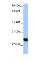 CHPF2 / CSGLCAT Antibody - Fetal liver lysate. Antibody concentration: 1.0 ug/ml. Gel concentration: 12%.  This image was taken for the unconjugated form of this product. Other forms have not been tested.