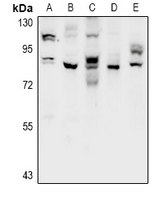 CHPF2 / CSGLCAT Antibody - Western blot analysis of CSGLCAT expression in CT26 (A), PC12 (B), HCT116 (C), LOVO (D), HEK293T (E) whole cell lysates.