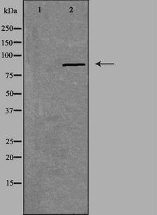 CHPF2 / CSGLCAT Antibody - Western blot analysis of extracts of Jurkat cells using CSGLCAT antibody. The lane on the left is treated with the antigen-specific peptide.