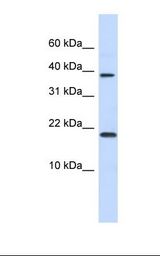 CHRAC1 Antibody - Fetal heart lysate. Antibody concentration: 1.0 ug/ml. Gel concentration: 10-20%.  This image was taken for the unconjugated form of this product. Other forms have not been tested.