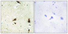CHRAC1 Antibody - Immunohistochemistry analysis of paraffin-embedded human brain tissue, using CHRC1 Antibody. The picture on the right is blocked with the synthesized peptide.