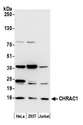 CHRAC1 Antibody - Detection of human CHRAC1 by western blot. Samples: Whole cell lysate (25 µg) from HeLa, HEK293T, and Jurkat cells prepared using NETN lysis buffer. Antibody: Affinity purified rabbit anti-CHRAC1 antibody used for WB at 0.4 µg/ml. Detection: Chemiluminescence with an exposure time of 60 seconds.