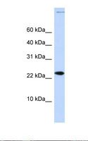 CHRAC1 Antibody - Fetal brain lysate. Antibody concentration: 1.0 ug/ml. Gel concentration: 10-20%.  This image was taken for the unconjugated form of this product. Other forms have not been tested.