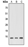 CHRAC1 Antibody - Western blot analysis of CHRAC1 expression in HEK293T (A); Raw264.7 (B); PC12 (C) whole cell lysates.