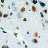 CHRAC1 Antibody - Immunohistochemical analysis of CHRAC1 staining in human brain formalin fixed paraffin embedded tissue section. The section was pre-treated using heat mediated antigen retrieval with sodium citrate buffer (pH 6.0). The section was then incubated with the antibody at room temperature and detected using an HRP conjugated compact polymer system. DAB was used as the chromogen. The section was then counterstained with hematoxylin and mounted with DPX. w
