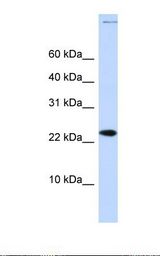 CHRAC1 Antibody - Fetal brain lysate. Antibody concentration: 1.0 ug/ml. Gel concentration: 10-20%.  This image was taken for the unconjugated form of this product. Other forms have not been tested.
