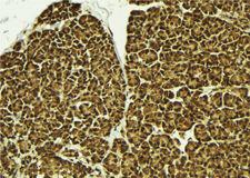 CHRAC1 Antibody - 1:100 staining mouse pancreas tissue by IHC-P. The sample was formaldehyde fixed and a heat mediated antigen retrieval step in citrate buffer was performed. The sample was then blocked and incubated with the antibody for 1.5 hours at 22°C. An HRP conjugated goat anti-rabbit antibody was used as the secondary.