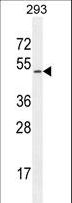 CHRDL1 Antibody - CHRDL1 Antibody western blot of 293 cell line lysates (35 ug/lane). The CHRDL1 antibody detected the CHRDL1 protein (arrow).