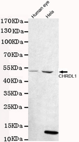 CHRDL1 Antibody - Western blot detection of CHRDL1 in human eye and HeLa cell lysates using CHRDL1 mouse monoclonal antibody (1:1000 dilution). Predicted band size: 57kDa. Observed band size: 52kDa.