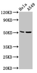 CHRDL1 Antibody - Positive Western Blot detected in Hela whole cell lysate, A549 whole cell lysate. All lanes: CHRDL1 antibody at 5.7 µg/ml Secondary Goat polyclonal to rabbit IgG at 1/50000 dilution. Predicted band size: 52, 44, 53 KDa. Observed band size: 52 KDa